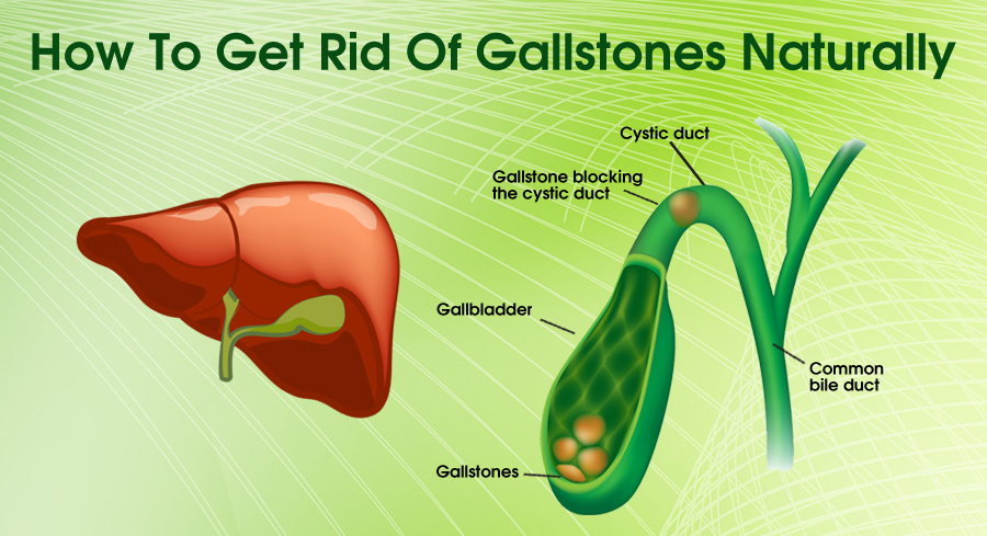 Gallbladder Good Health Day 2018