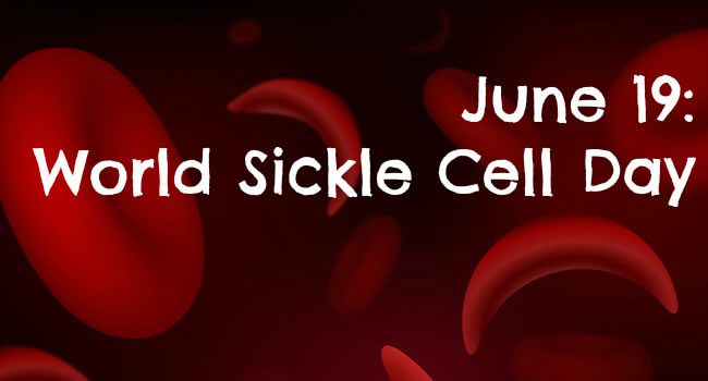 When is World Sickle Cell Day This Year 